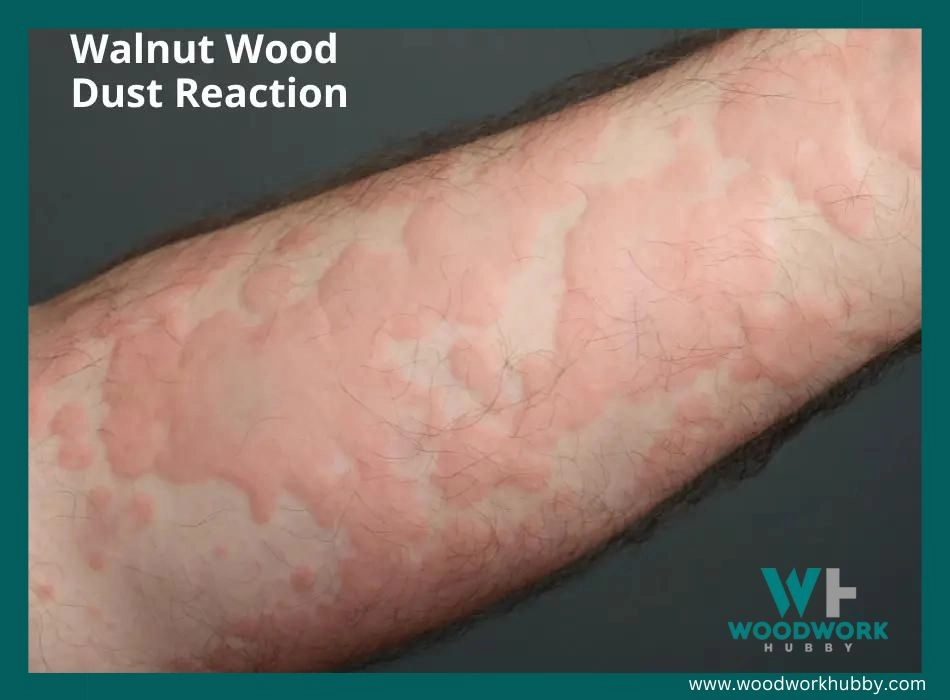 Walnut wood allergy discussion on Facebook